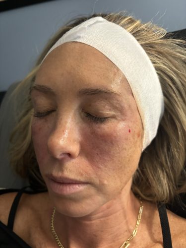 Lapuroon Aurora Vivid photo review