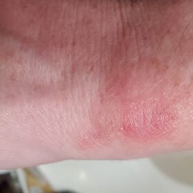 Laennec 10 ampules photo review