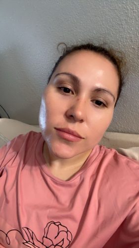 Laennec 10 ampules photo review