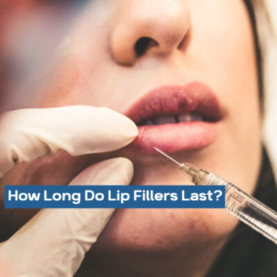 How Long Do Lip Fillers Last?