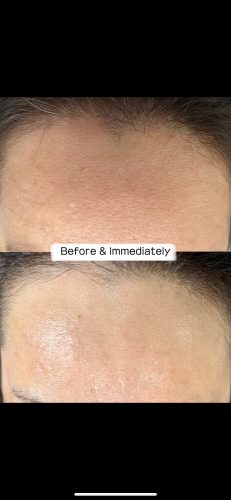 EXOXE Face photo review