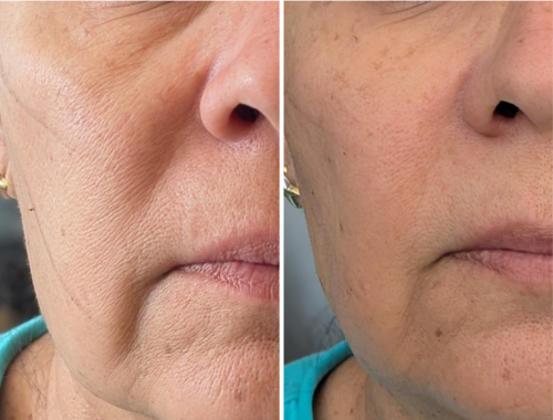 EXOXE Face photo review