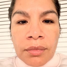 EXOXE Face photo review