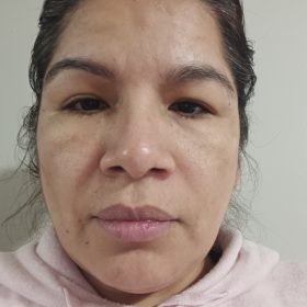 EXOXE Face photo review