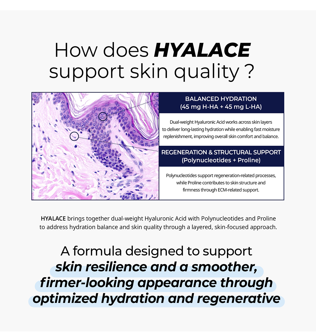 Hyalace - photo 10