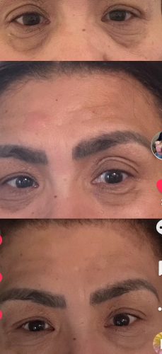 Juve Eyes photo review