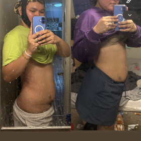 Dr. Lipo+ (Body) photo review