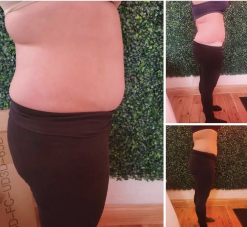 Dr. Lipo+ (Body) photo review