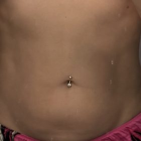 Dr. Lipo+ (Body) photo review