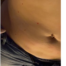 Dr. Lipo+ (Body) photo review