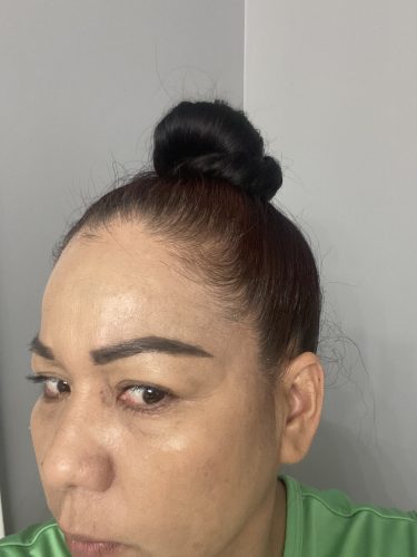 Juve Eyes photo review