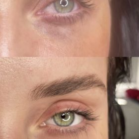 Curenex eye photo review