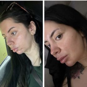 Curenex eye photo review