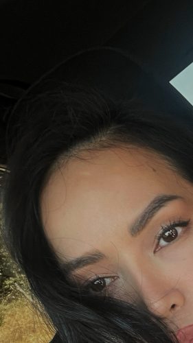 Metox 100 Units photo review