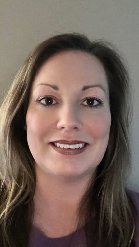 Metox 100 Units photo review