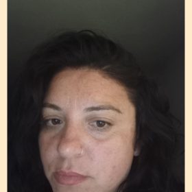 Metox 100 Units photo review