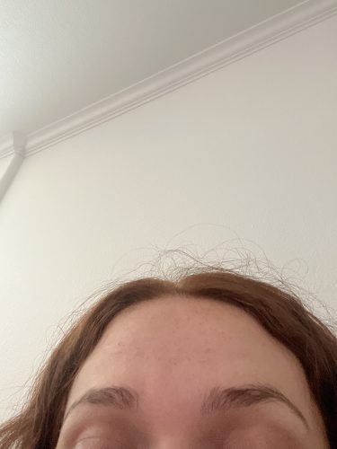 Metox 100 Units photo review