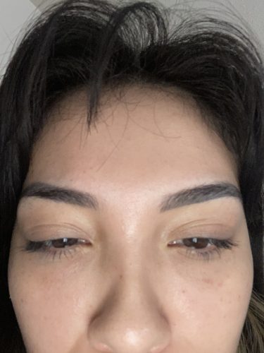 Metox 100 Units photo review