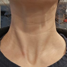 Nabota 200 Units photo review