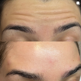 Nabota 200 Units photo review