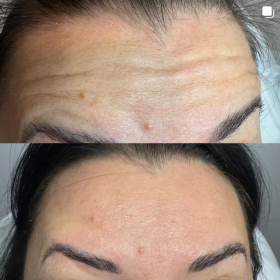 Nabota 200 Units photo review