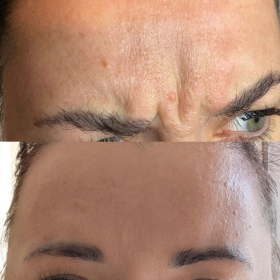 Nabota 200 Units photo review