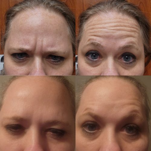 Nabota 200 Units photo review