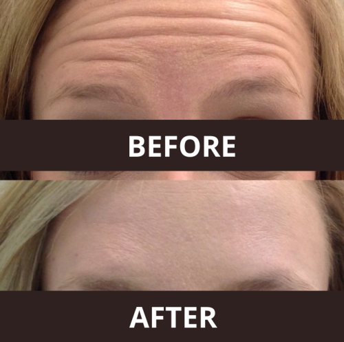 Nabota 200 Units photo review