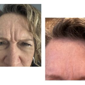 Nabota 200 Units photo review