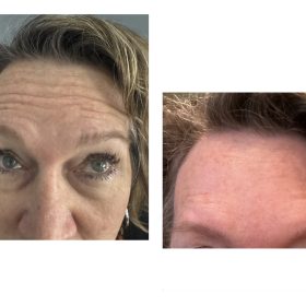 Nabota 200 Units photo review