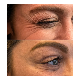 Nabota 200 Units photo review