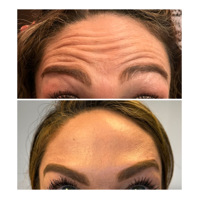 Nabota 200 Units photo review