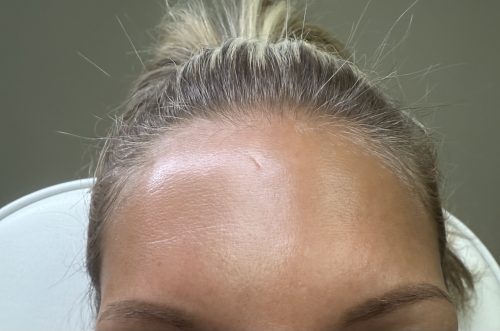 Nabota 200 Units photo review