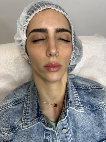 Nabota 200 Units photo review