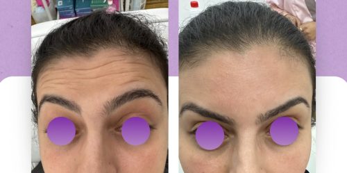 Nabota 200 Units photo review