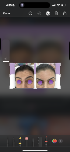 Nabota 200 Units photo review