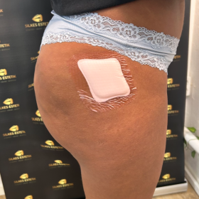 Venufill Body Filler Hard Type photo review