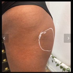 Venufill Body Filler Hard Type photo review