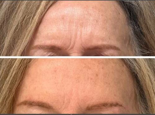 Nabota 200 Units photo review