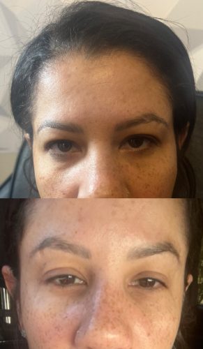 Nabota 200 Units photo review