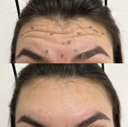 Nabota 200 Units photo review