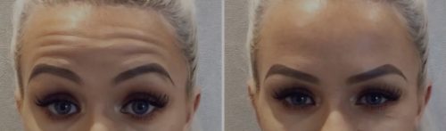 Nabota 200 Units photo review