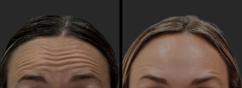 Nabota 200 Units photo review