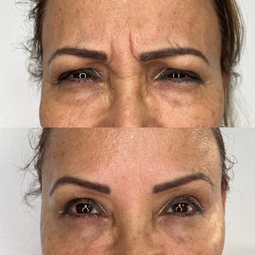 Nabota 200 Units photo review