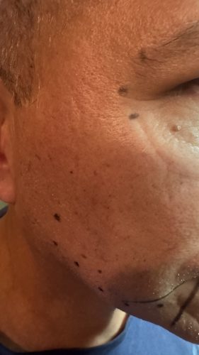 Bienox 100 units photo review