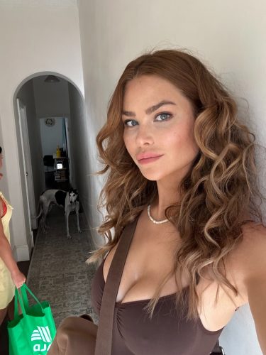 Botulax 300 Units photo review