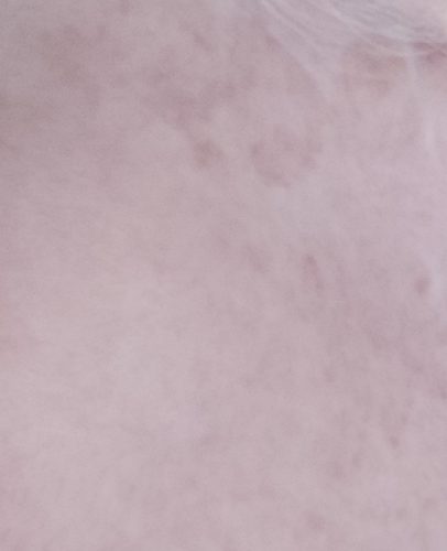 Curenex Skin Booster photo review