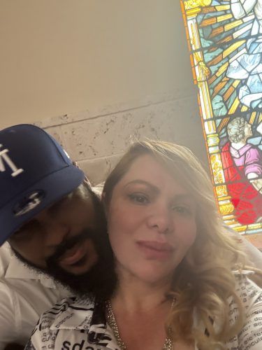 Botulax 300 Units photo review