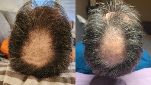 Sappire Hair Rich photo review