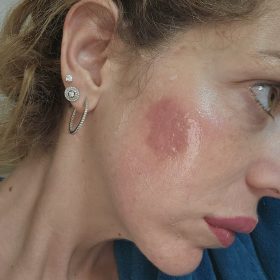 Juve Face photo review